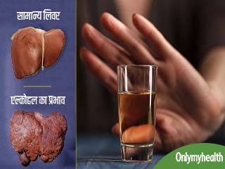 एल्कोहल के ज्यादा सेवन से सिरोसिस ही नहीं, होता है इन 5 बीमारियों का खतरा